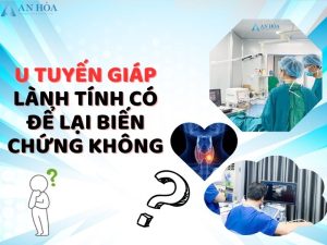 U lành tính tuyến giáp