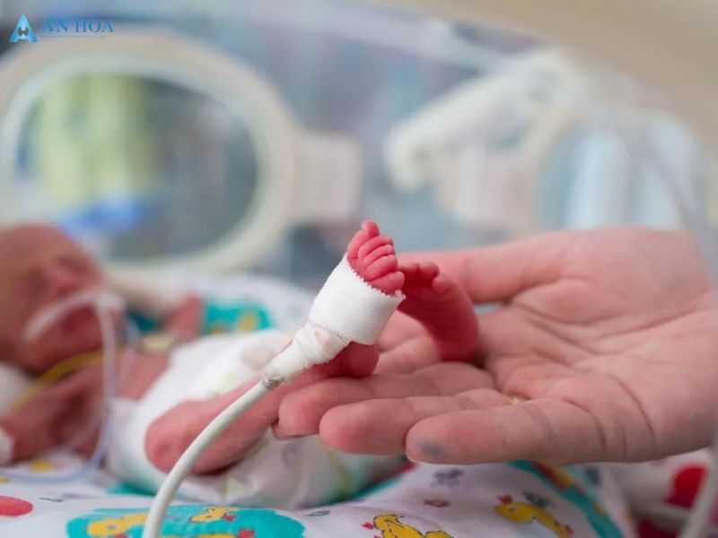 Biểu hiện của cường giáp