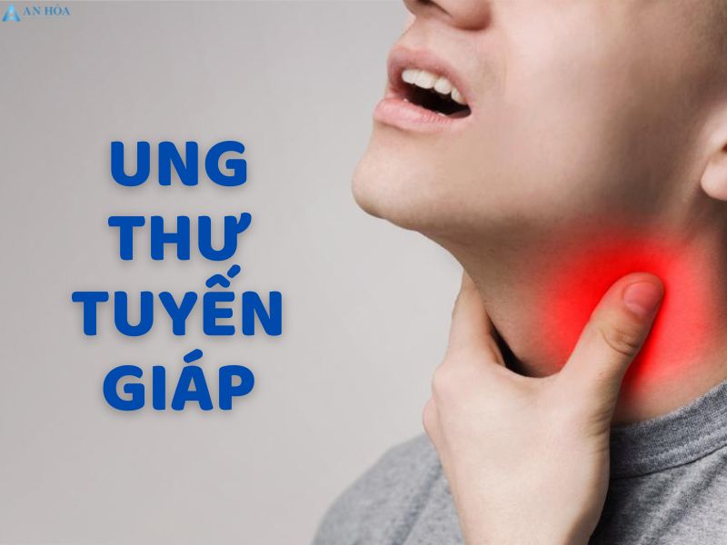 Điều trị ung thư tuyến giáp