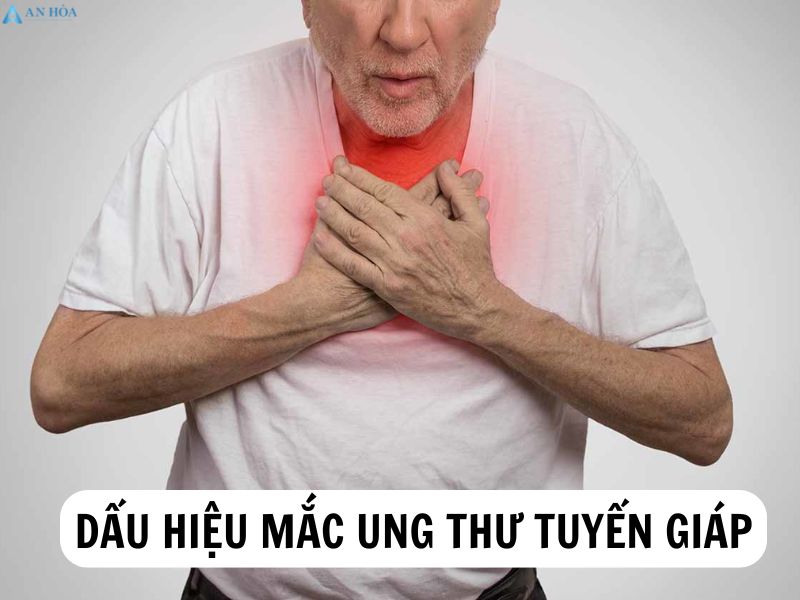 Điều trị ung thư tuyến giáp