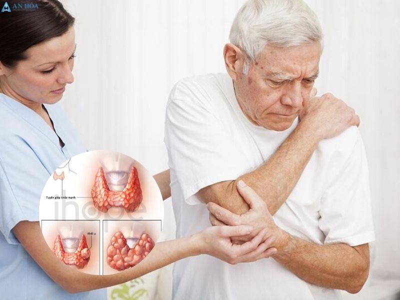 Nhân và nang tuyến giáp