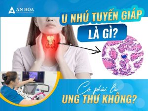 U nhú tuyến giáp