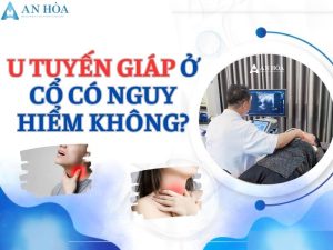 U tuyến giáp ở cổ có nguy hiểm không