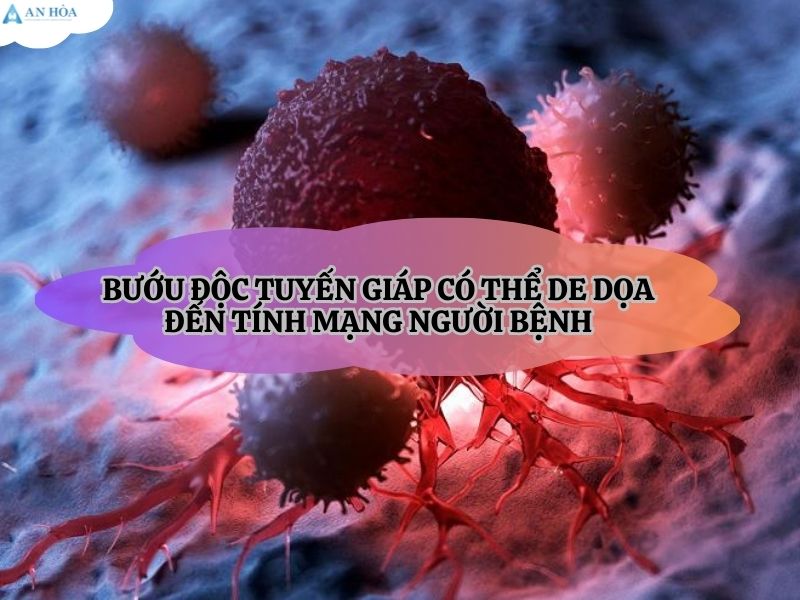 Bướu độc tuyến giáp