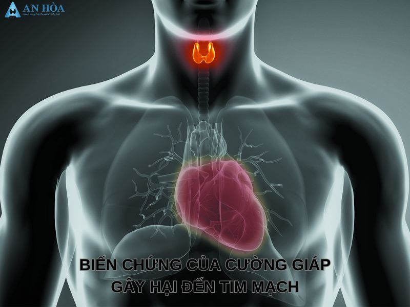 Chữa bệnh cường giáp