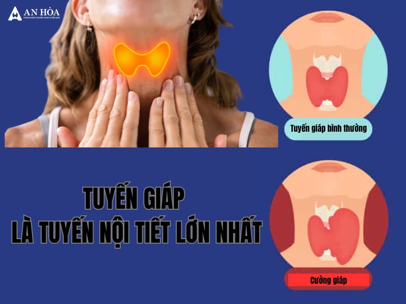 Chữa bệnh cường giáp