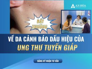Dấu hiệu của ung thư tuyến giáp