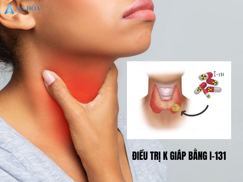Điều trị K giáp