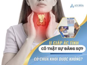 U ác tuyến giáp