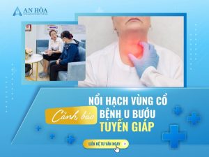 U bướu tuyến giáp