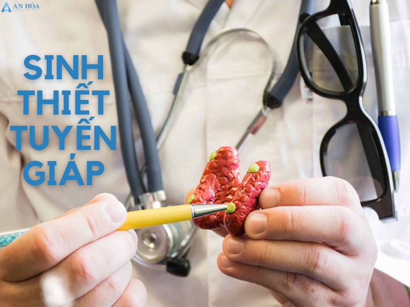 U giáp ác tính