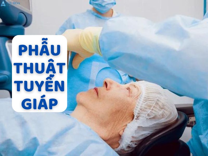 U tuyến giáp thể nang