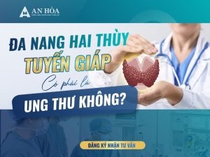 Đa nang hai thùy tuyến giáp