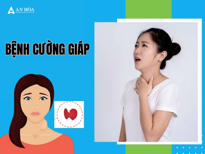 Nguyên nhân cường giáp