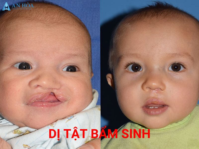 Suy giáp có nguy hiểm