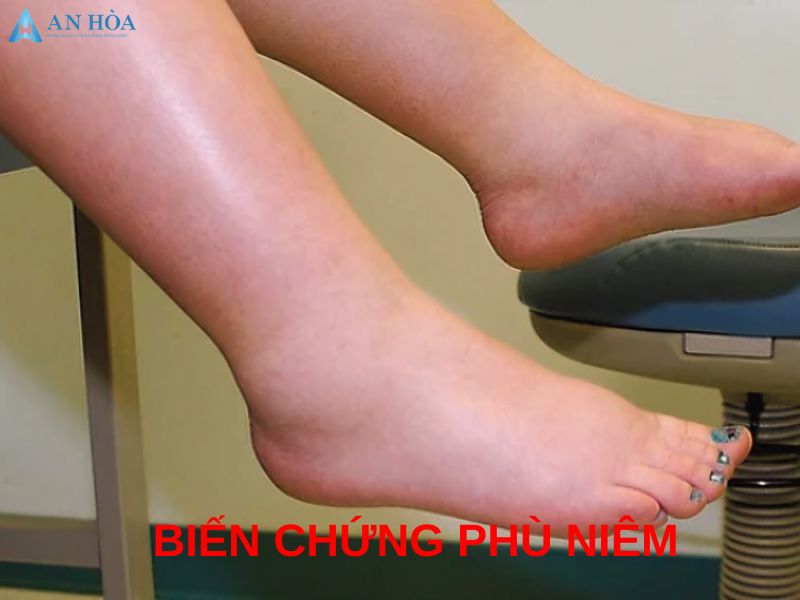 Suy giáp có nguy hiểm