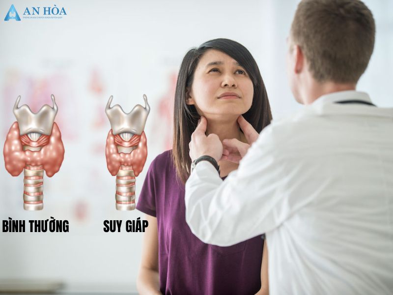 Suy giáp có nguy hiểm
