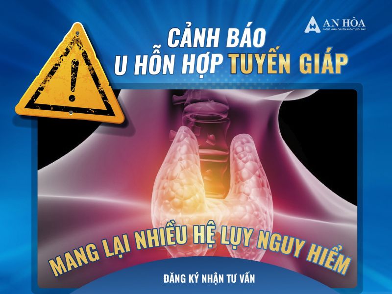 U hỗn hợp tuyến giáp
