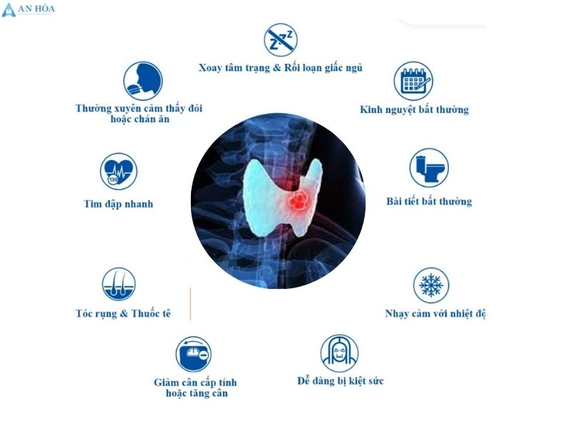 Điều trị u tuyến giáp ác tính