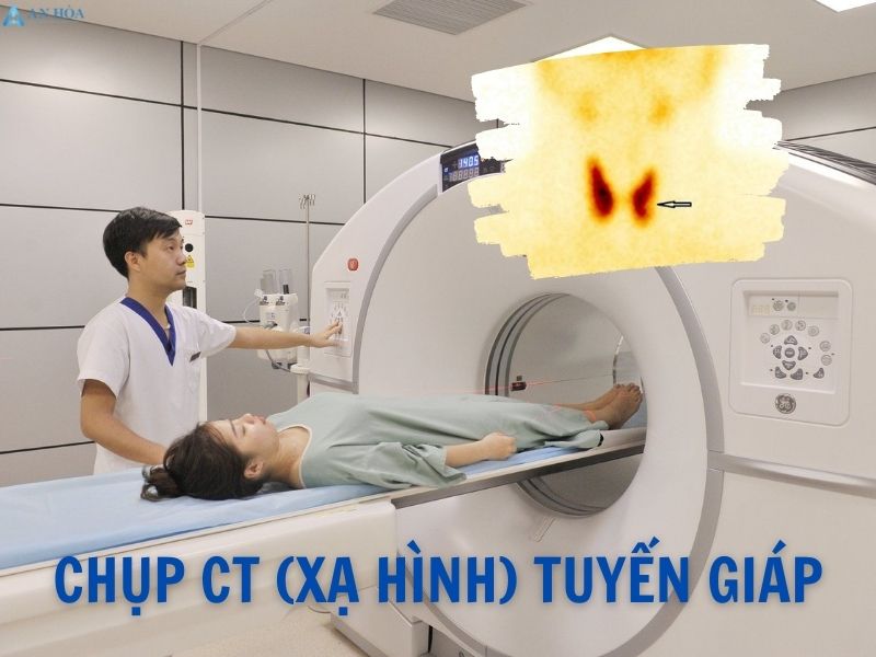 Điều trị u tuyến giáp ác tính