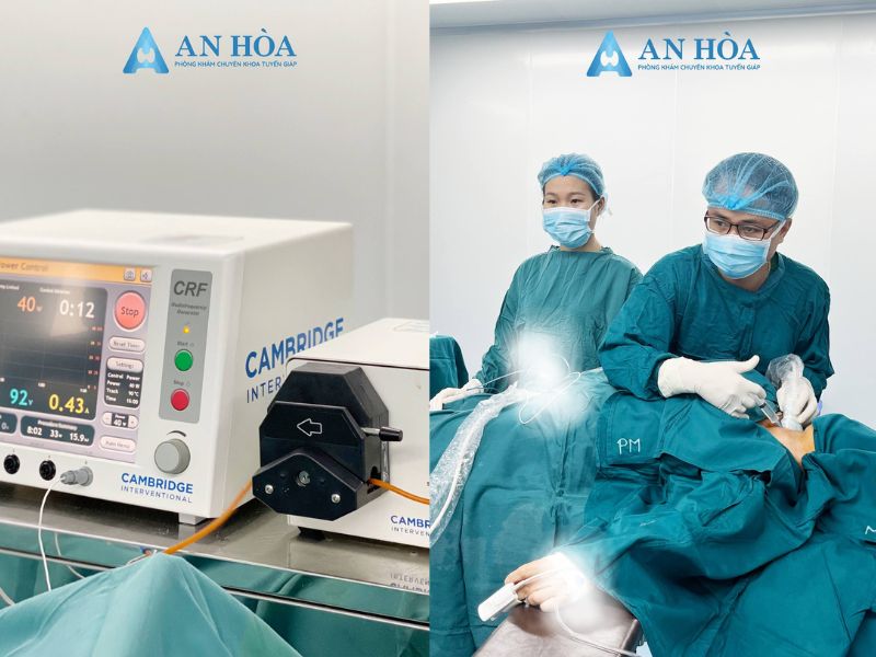 Đốt sóng cao tần tuyến giáp