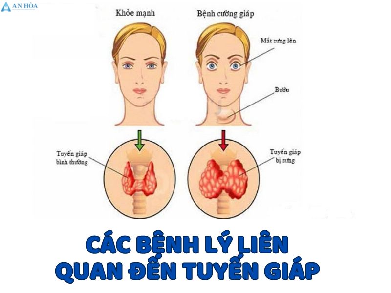 Kích thước thùy tuyến giáp
