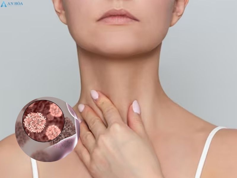 Nhân tuyến giáp ác tính