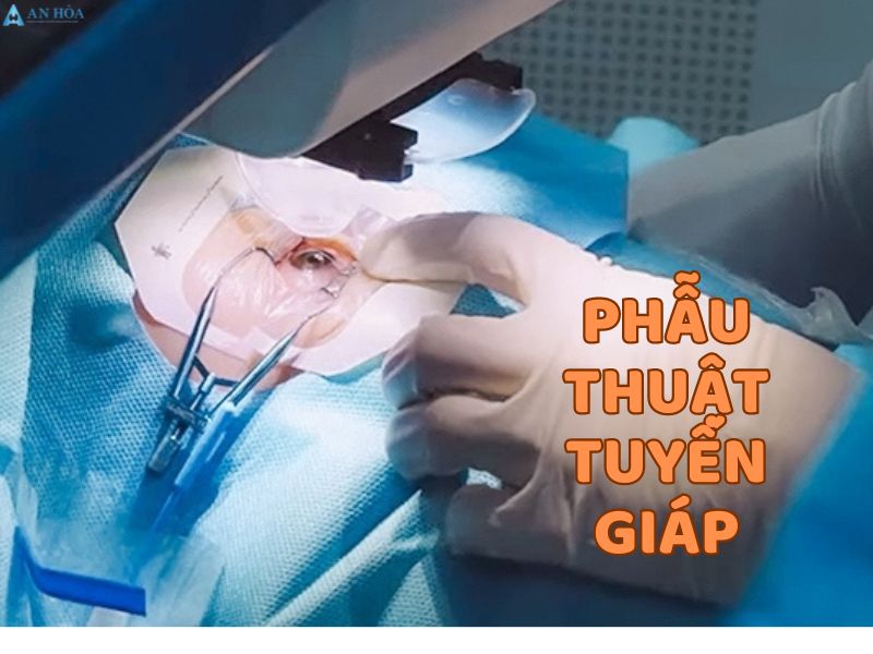 Nhân tuyến giáp ác tính