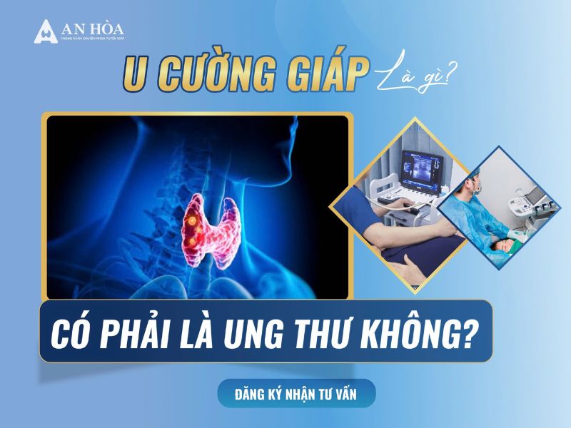 U cường giáp