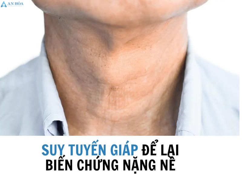 Suy giảm tuyến giáp có nguy hiểm không