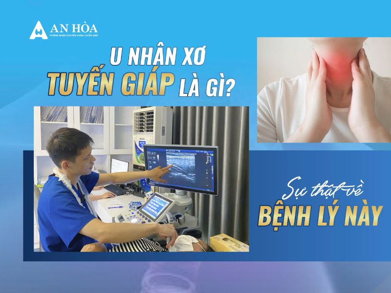 U nhân xơ tuyến giáp