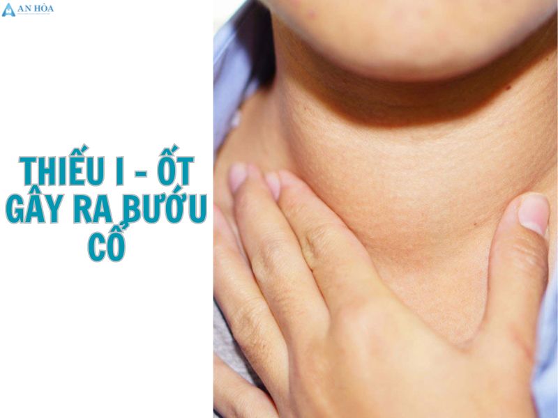 Nguyên nhân bị bệnh tuyến giáp